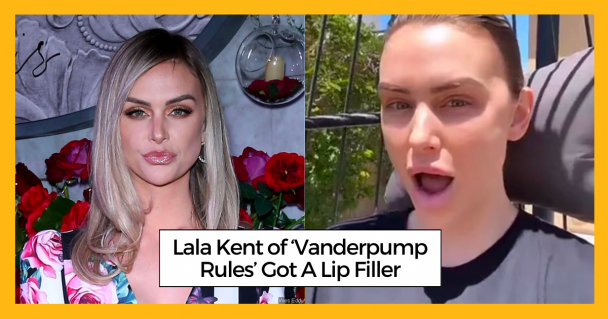 Lala Kent of ‘Vanderpump Rules’ Got A Lip Filler